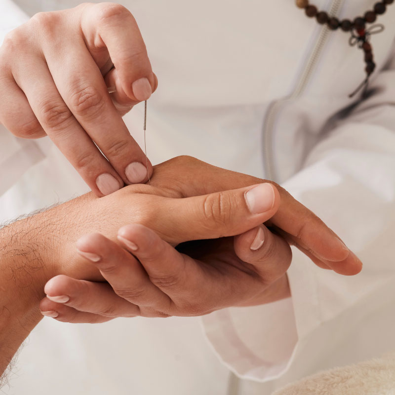 Accupuncture